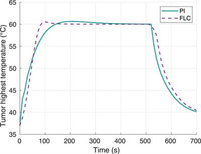 Tissue damage-tracking control system for image-guided photothermal therapy of cancer